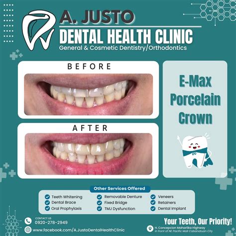 justo dental clinic|Tana specialty dental clinic Vacancy .